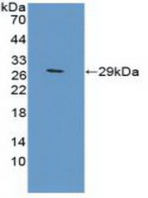 Polyclonal Antibody to Transferrin Receptor 2 (TFR2)