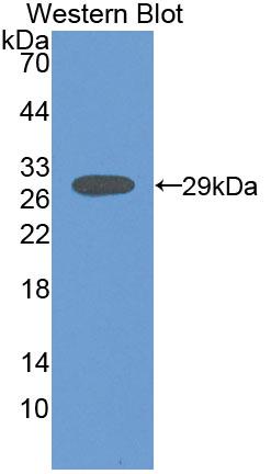 Polyclonal Antibody to Creatine Kinase, Mitochondrial 1A (CKMT1A)