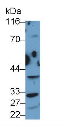 Polyclonal Antibody to Cathepsin K (CTSK)