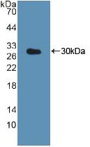 Polyclonal Antibody to Cathepsin K (CTSK)