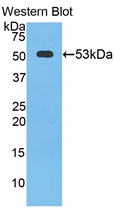 Polyclonal Antibody to Cathepsin K (CTSK)