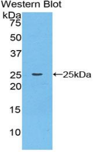 Polyclonal Antibody to Cathepsin K (CTSK)