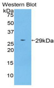 Polyclonal Antibody to Transportin 1 (TNPO1)