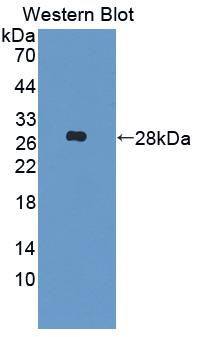 Polyclonal Antibody to Insulin Like Growth Factor Binding Protein 6 (IGFBP6)