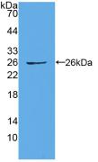 Polyclonal Antibody to Connexin 43 (CX43)