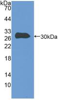 Polyclonal Antibody to Talin 1 (TLN1)