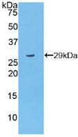 Polyclonal Antibody to Poly ADP Ribose Polymerase (PARP)