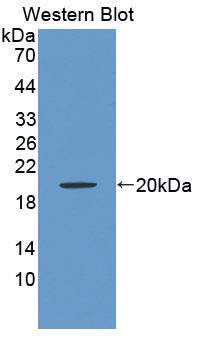 Polyclonal Antibody to B-Cell Activation Factor Receptor (BAFFR)