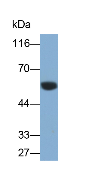 PAA284Hu01.jpg