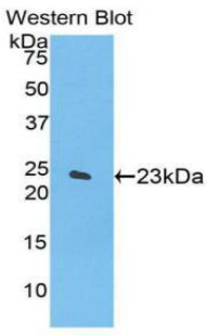 Polyclonal Antibody to Alpha-Fodrin (SPTAN1)