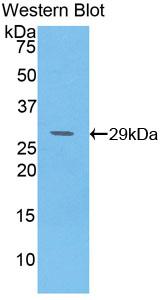 Polyclonal Antibody to Glutamate Dehydrogenase 1 (GLUD1)