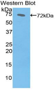 Polyclonal Antibody to Heat Shock 70kDa Protein 1B (HSPA1B)