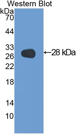 Polyclonal Antibody to Galectin 3 (GAL3)