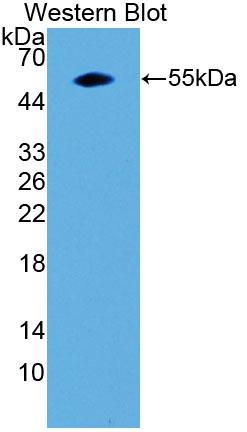 Polyclonal Antibody to Galectin 3 (GAL3)