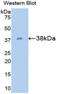 Polyclonal Antibody to Galectin 4 (GAL4)