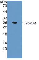 Polyclonal Antibody to Cathepsin L (CTSL)