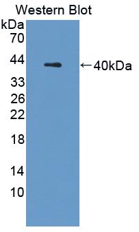 Polyclonal Antibody to Cathepsin L (CTSL)