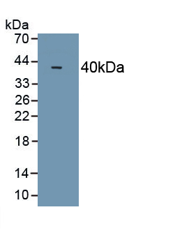 Polyclonal Antibody to Galectin 8 (GAL8)