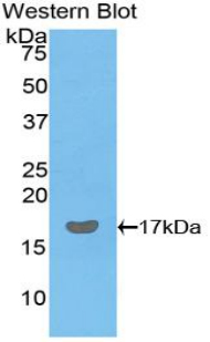 Polyclonal Antibody to Galectin 9 (GAL9)