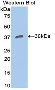 Polyclonal Antibody to Apolipoprotein H (APOH)