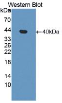 Polyclonal Antibody to Apolipoprotein H (APOH)