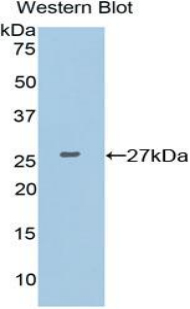 Polyclonal Antibody to X-Ray Repair Cross Complementing 6 (XRCC6)