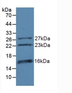Polyclonal Antibody to Chromodomain Helicase DNA Binding Protein 3 (CHD3)