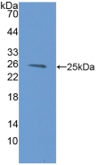 Polyclonal Antibody to Proteasome subunit beta type-9 (PSMB9)