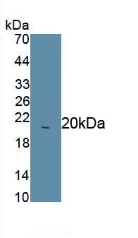 Polyclonal Antibody to Asprosin