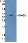 Polyclonal Antibody to Microtubule Associated Protein 1A (MAP1A)