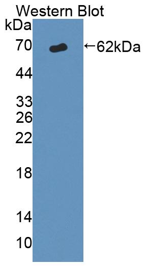 Polyclonal Antibody to ATP Binding Cassette Transporter D1 (ABCD1)