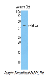 Polyclonal Antibody to Fatty Acid Binding Protein 6, Ileal (FABP6)