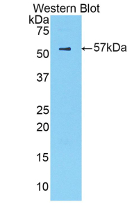 Polyclonal Antibody to Cathepsin A (CTSA)