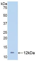 Polyclonal Antibody to Platelet/Endothelial Cell Adhesion Molecule (PECAM1)