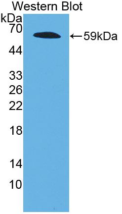 Polyclonal Antibody to Fibrillin 2 (FBN2)