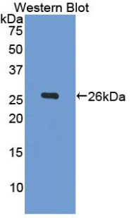 Polyclonal Antibody to Gelsolin (GSN)