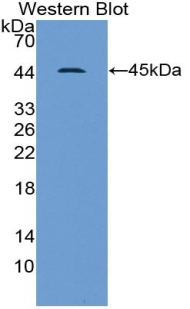 Polyclonal Antibody to Gelsolin (GSN)