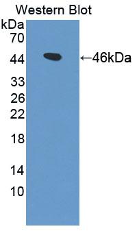 Polyclonal Antibody to Gelsolin (GSN)