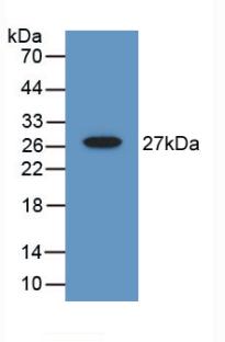 Polyclonal Antibody to Gelsolin (GSN)