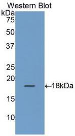 Polyclonal Antibody to Retinol Binding Protein 2, Cellular (RBP2)