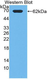 Polyclonal Antibody to Phosphoinositide-3-Kinase Class-2-Alpha Polypeptide (PIK3C2a)