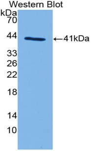 Polyclonal Antibody to Complement Component 3a (C3a)