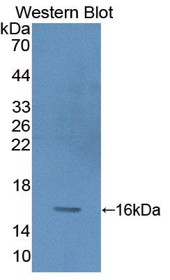 Polyclonal Antibody to Protein Kinase Inhibitor Gamma (PKIg)