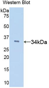 Polyclonal Antibody to Tissue Factor Pathway Inhibitor (TFPI)