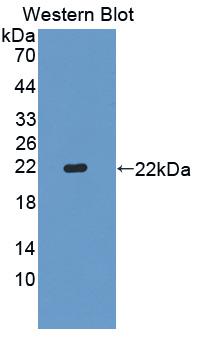 Polyclonal Antibody to Sex Hormone Binding Globulin (SHBG)