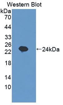 Polyclonal Antibody to Sex Hormone Binding Globulin (SHBG)