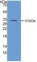 Polyclonal Antibody to Transforming Growth Factor Beta Receptor I (TGFbR1)