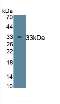 Polyclonal Antibody to Transforming Growth Factor Beta Receptor I (TGFbR1)