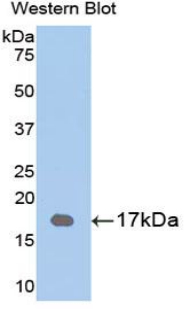 Polyclonal Antibody to Retinol Binding Protein 1, Cellular (RBP1)