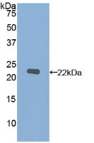 Polyclonal Antibody to Matrix Metalloproteinase 12 (MMP12)